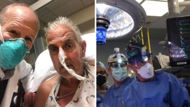 Photo of In a first, 57-year-old US man gets pig heart: A brief history of animal-to-human heart transplants