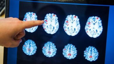 Photo of New study shows what human body experiences right before death