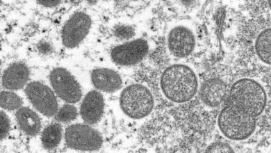 Photo of WHO: Monkeypox won’t turn into pandemic, but many unknowns
