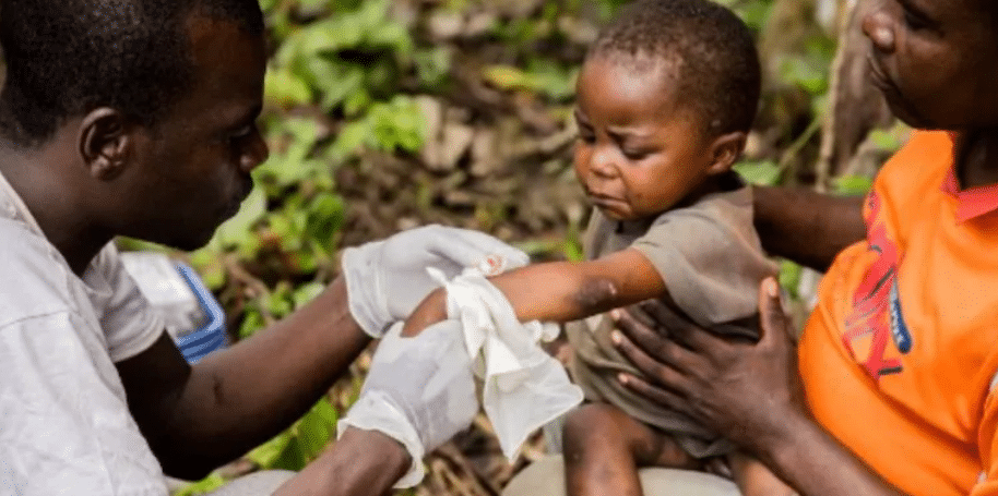 World Health Network declares monkeypox outbreak a pandemic