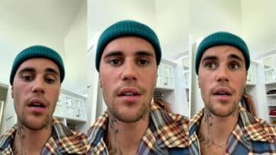 Photo of Justin Bieber says suffering from facial paralysis