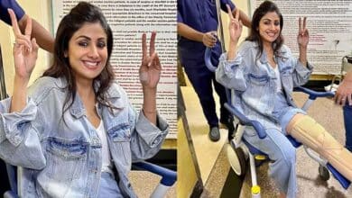Photo of Shilpa Shetty breaks her leg during shooting