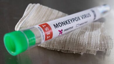 Photo of Three labs designated in Dhaka for monkeypox test