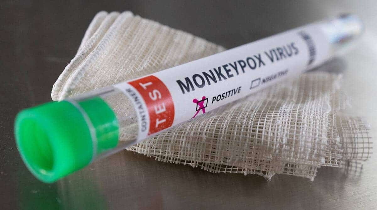 Three labs designated in Dhaka for monkeypox test
